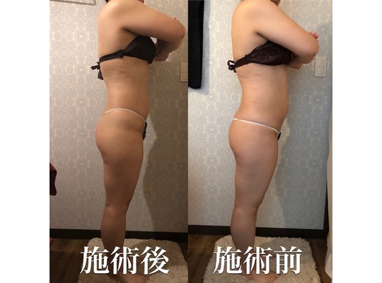 ビフォーアフター