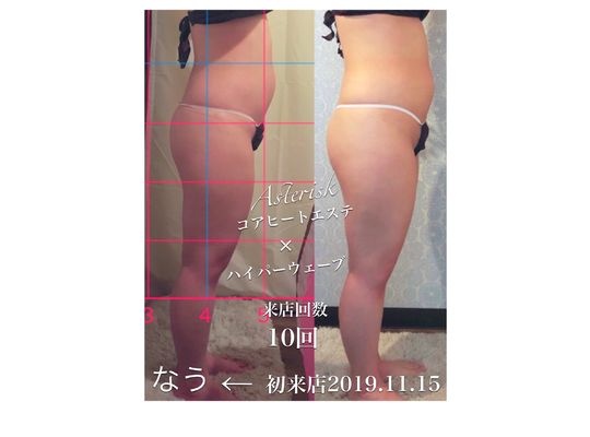 ビフォアフォ10回