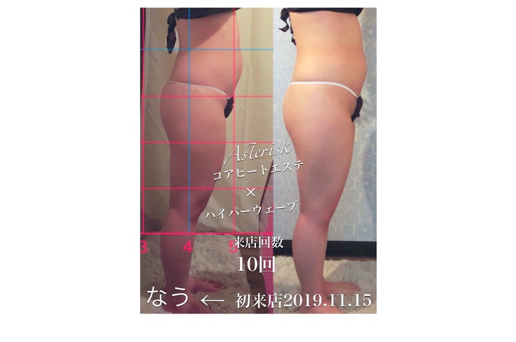 ビフォアフォ10回