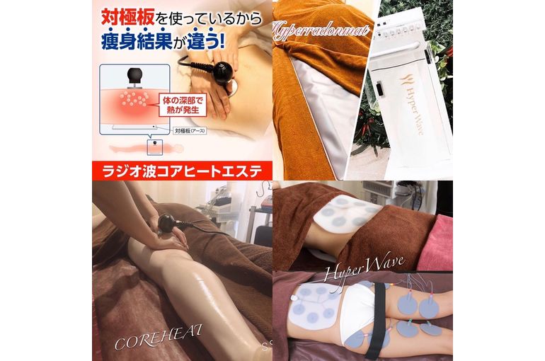 ビフォーアフター